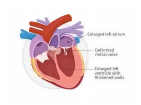infographic